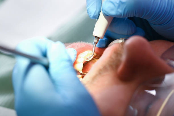 Best After-Hours Emergency Dentist in Clayco, MO