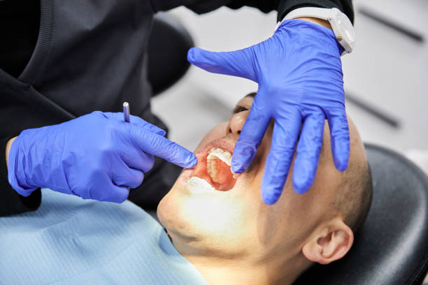 Best Emergency Tooth Extraction in Clayco, MO